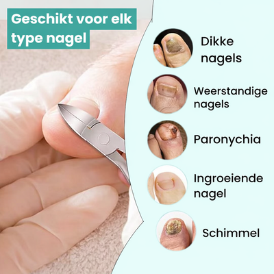 Professionele nagelknipper voor schimmelinfecties